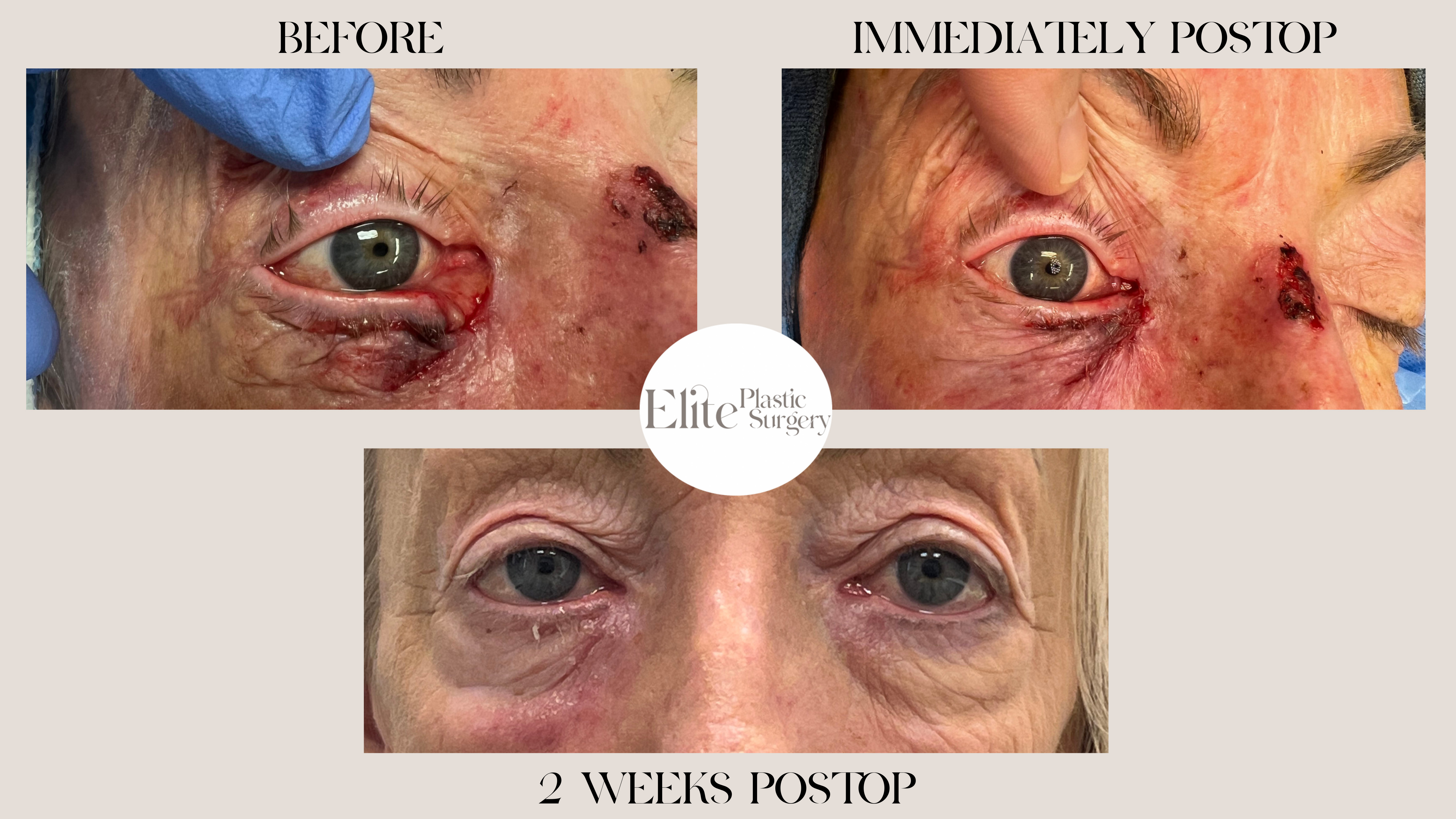 Oculoplastic Surgery Before & After Gallery - Patient 193010 - Image 1