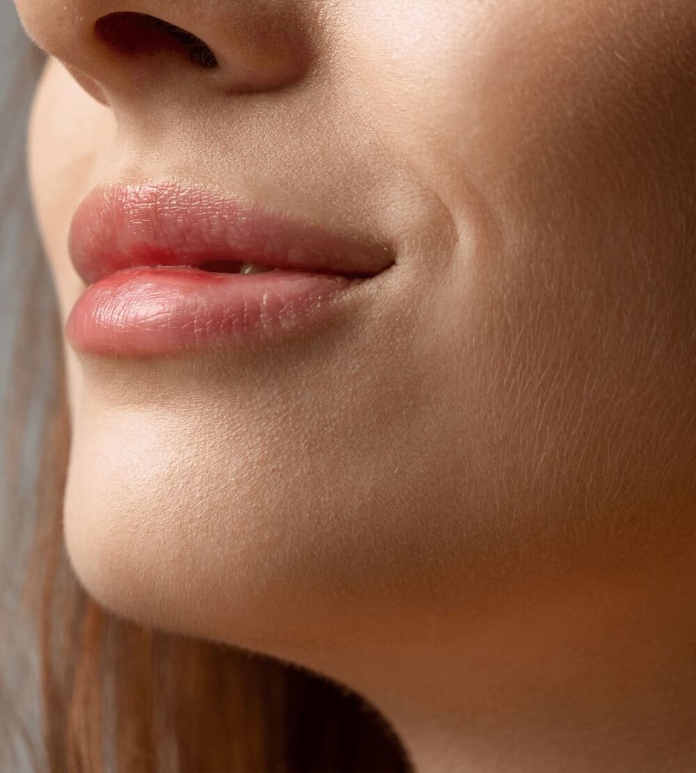Facial Nerve Paralysis