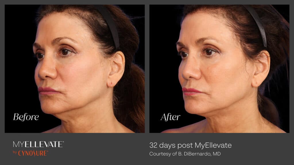 1738954811 microsoftteams image 3 - Elite Plastic Surgery