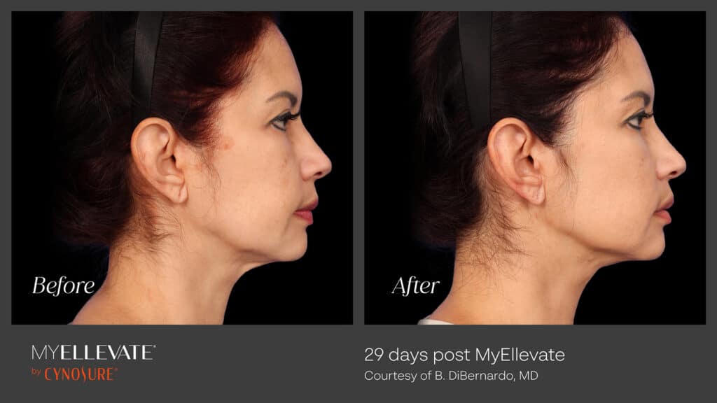 1738954857 microsoftteams image 5 - Elite Plastic Surgery