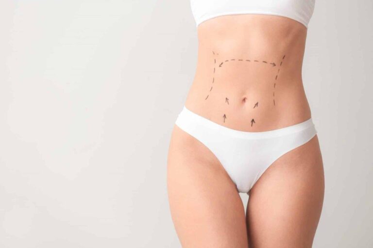 Tummy Tuck and Lipo360