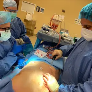 1713462198 elite vaserlipo a - Elite Plastic Surgery