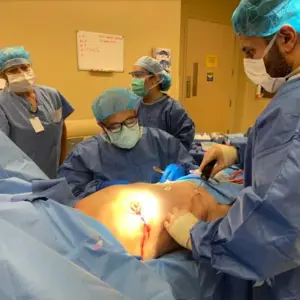 1713462221 elite vaserlipo c - Elite Plastic Surgery