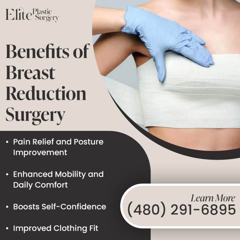 Benefits of Breast Reduction Surgery
