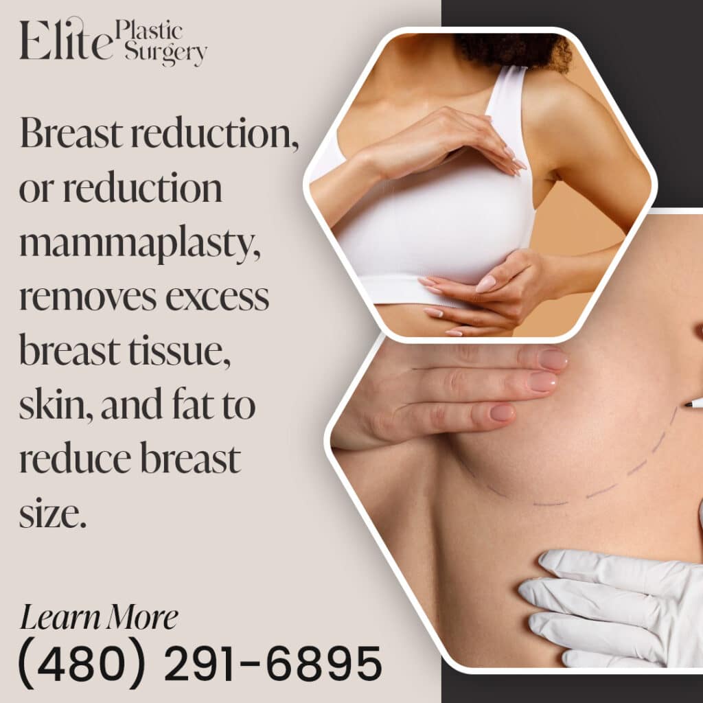 Breast Reduction