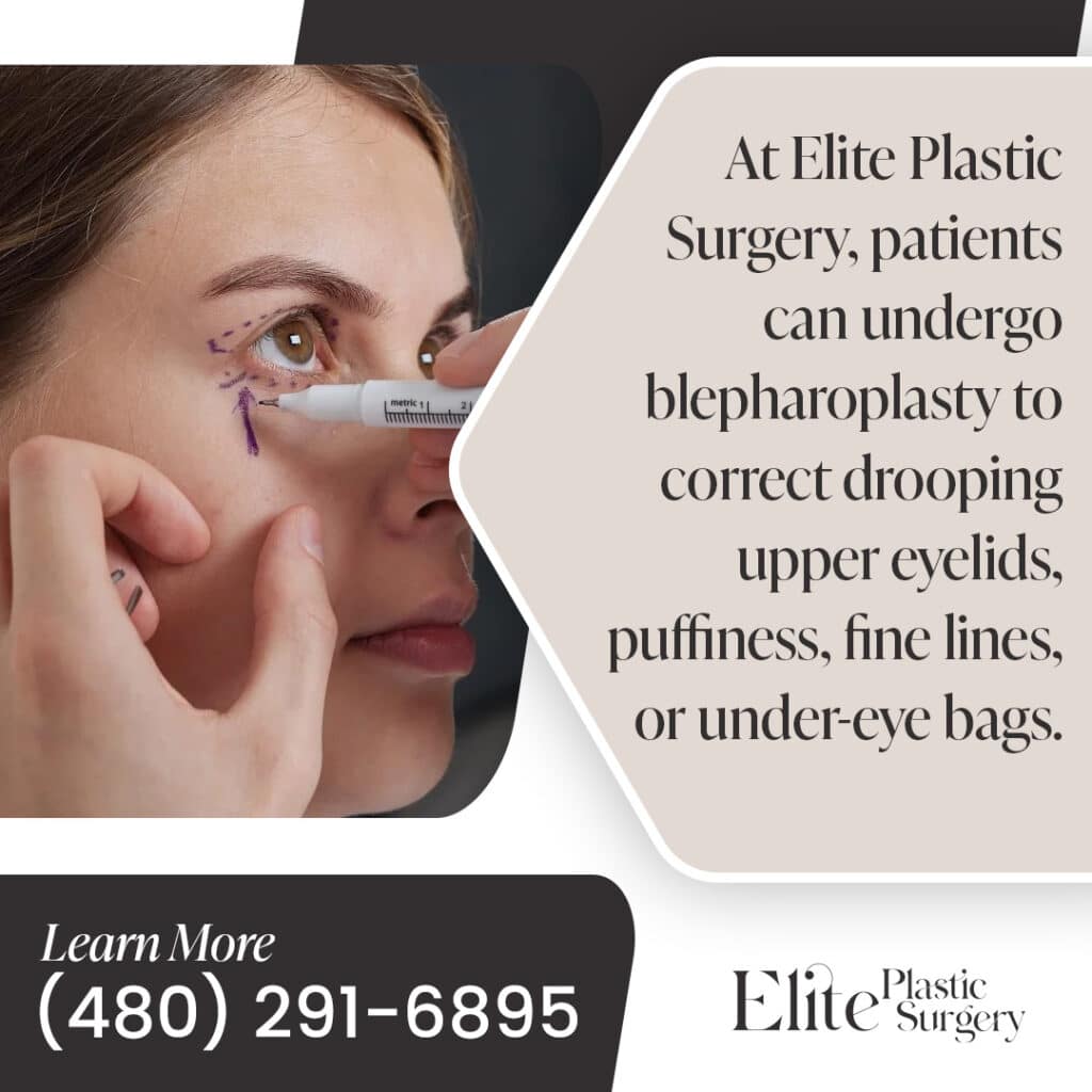 Eyelid Blepharoplasty