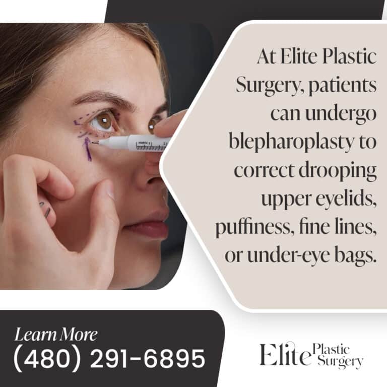 Eyelid Blepharoplasty