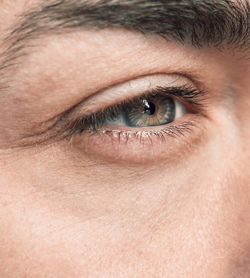 Eyelid Surgery