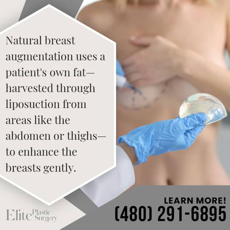 Natural Breast Augmentation
