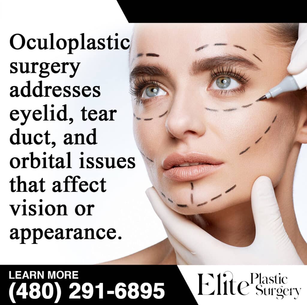 Types Of Oculoplastic Surgery