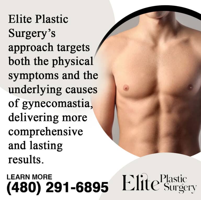 What is Gynecomastia