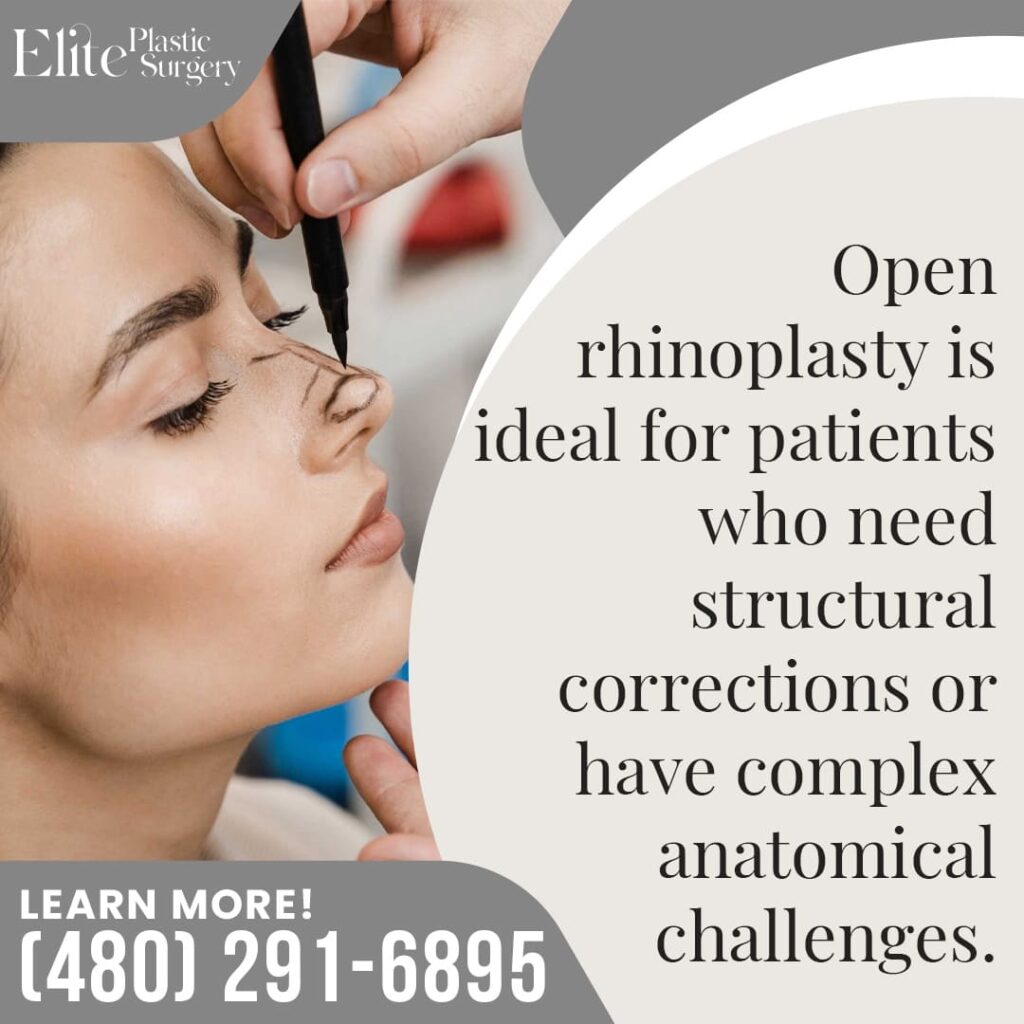 A surgeon at Elite Plastic Surgery in Chandler marking a patient's nose for an open rhinoplasty procedure
