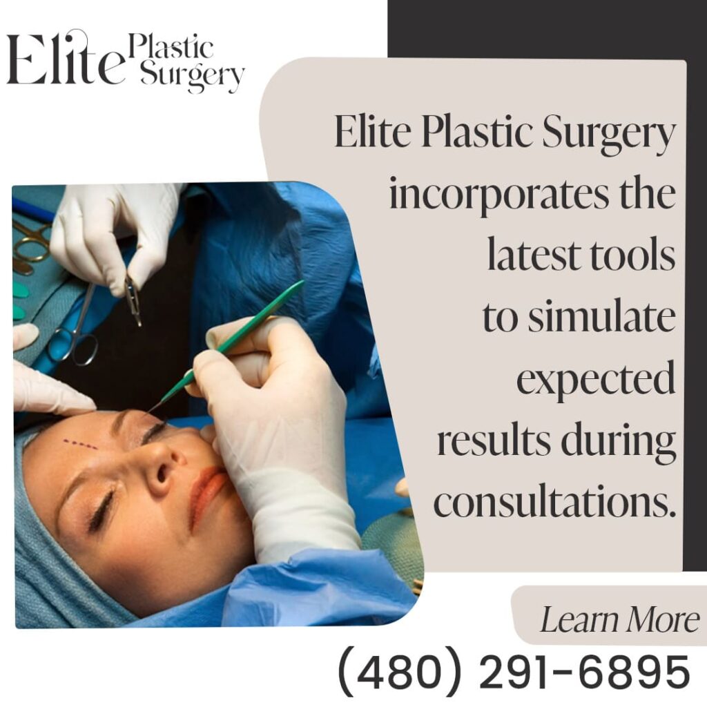 Using the latest tools to simulate expected results during consultations for oculoplastic surgery in Phoenix