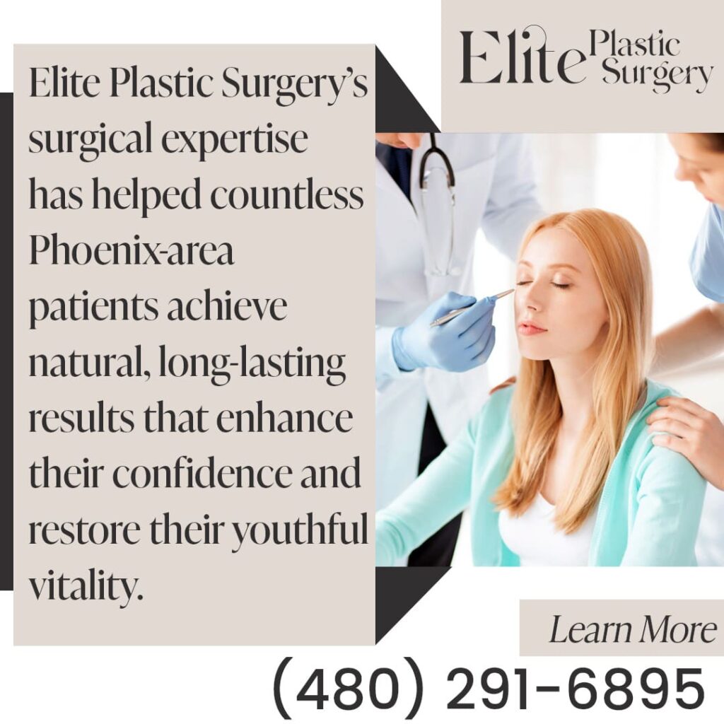 Woman with surgical markings for a deep plane SMAS facelift at Elite Plastic Surgery in Phoenix
