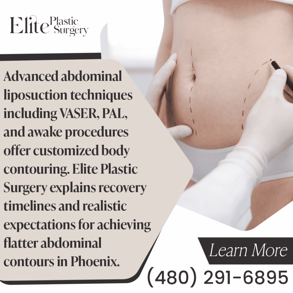 A surgeon marks a patient's abdomen before liposuction, representing advanced techniques like VASER, PAL, and awake procedures for body contouring offered at Elite Plastic Surgery.
