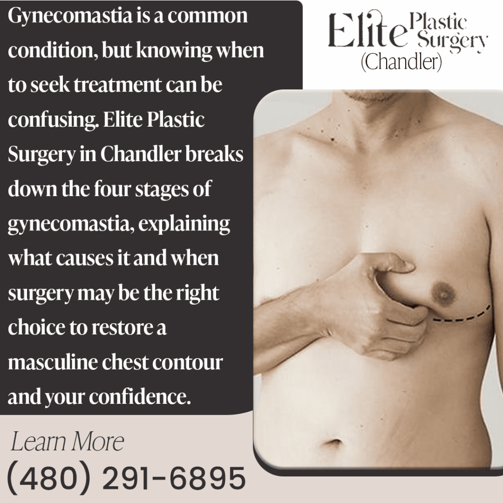 When is gynecomastia operation recommended? Persistent condition, psychological distress, moderate to severe stages, cosmetic goals