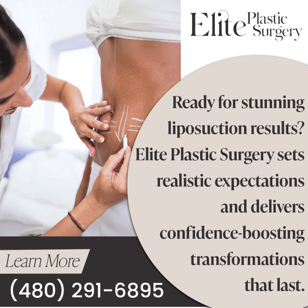 Ready for stunning liposuction results? Elite Plastic Surgery sets realistic expectations for confidence-boosting transformations that last.