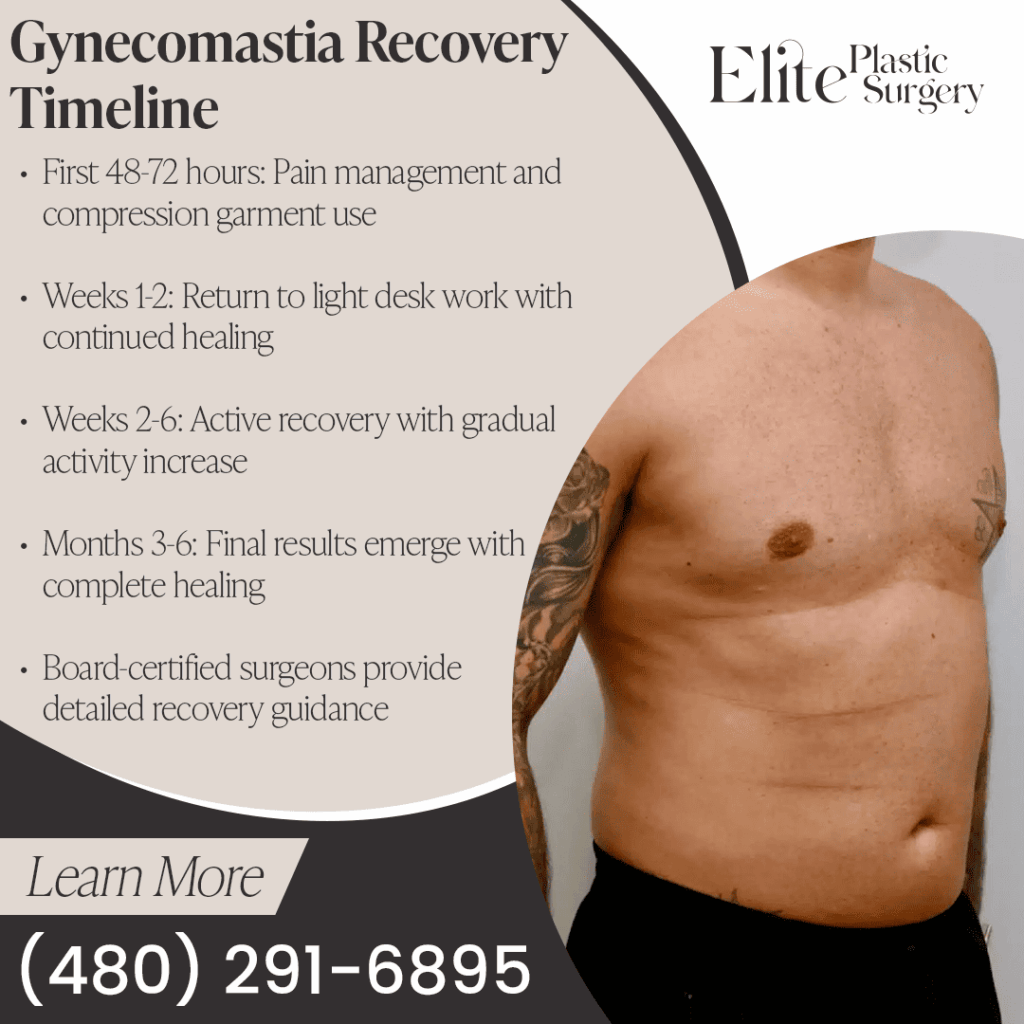 A man's torso is shown after gynecomastia surgery, with a timeline detailing the recovery phases from the initial 48 hours to the final results at 3-6 months.