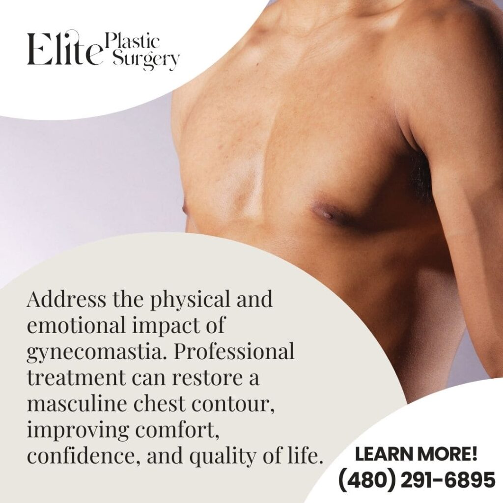 A man's torso is shown, accompanying text about how professional gynecomastia treatment can restore a masculine chest contour, improving comfort and confidence.