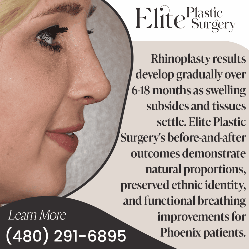 A profile view of a woman's nose shows the gradual, natural results of rhinoplasty. The text emphasizes how Elite Plastic Surgery focuses on preserving ethnic identity while improving breathing and aesthetics.