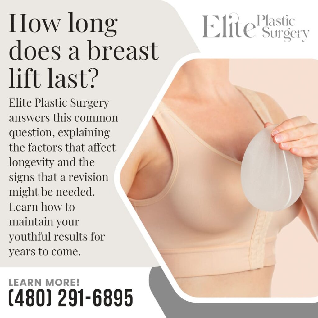 Woman holding a breast implant; answers how long a breast lift lasts, explaining factors affecting longevity and signs a revision might be needed.