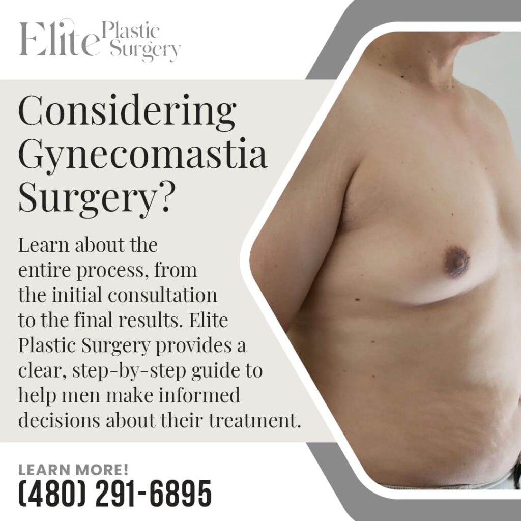 Image of a man's bare chest with gynecomastia; offers a clear, step-by-step guide to the entire gynecomastia surgery process, from consultation to results.