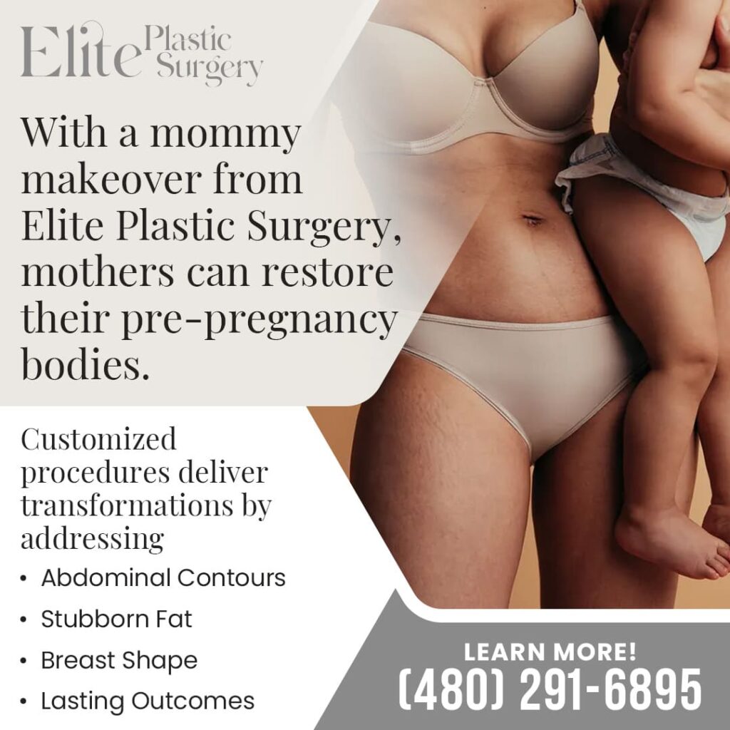 Mother holding baby, discussing mommy makeover benefits like abdominal contouring, breast shape, and lasting outcomes at Elite Plastic Surgery.