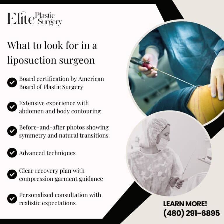 Liposuction of the abdomen