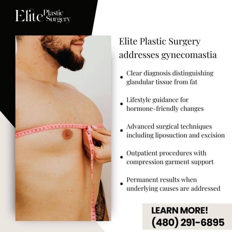 gynecomastia treatment