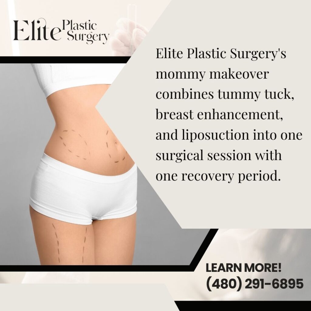 mommy makeover 