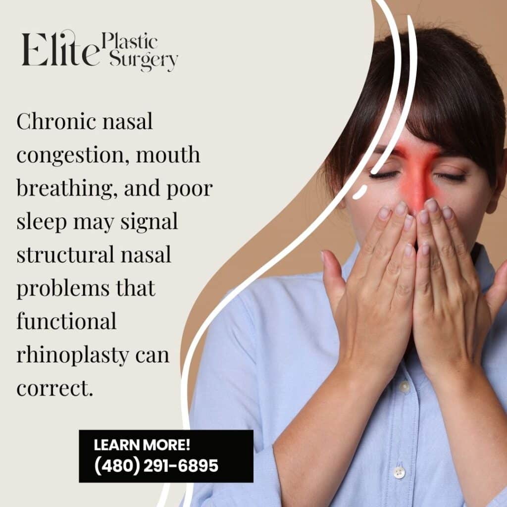 rhinoplasty near you