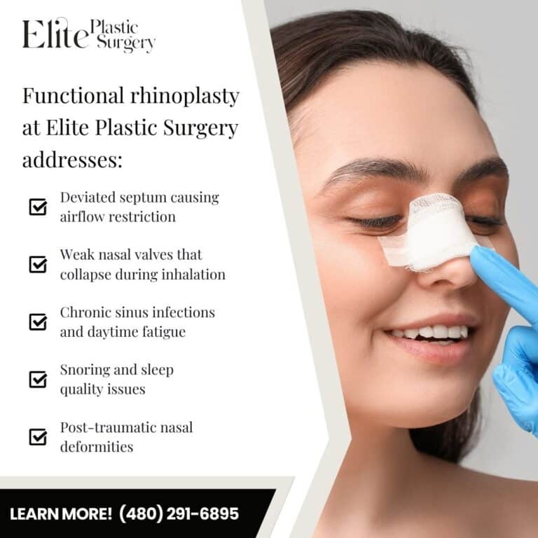 rhinoplasty near you