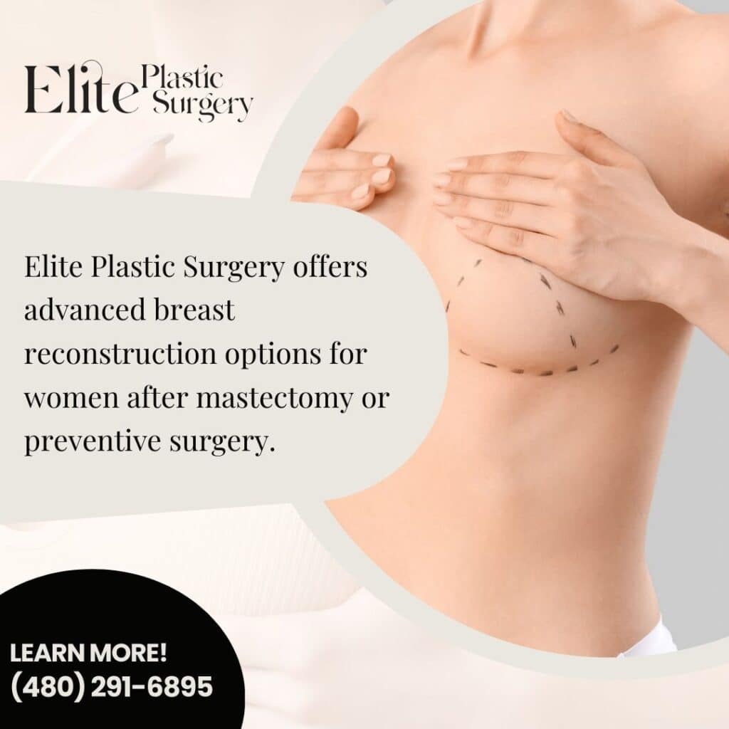 DIEP flap surgery in Phoenix