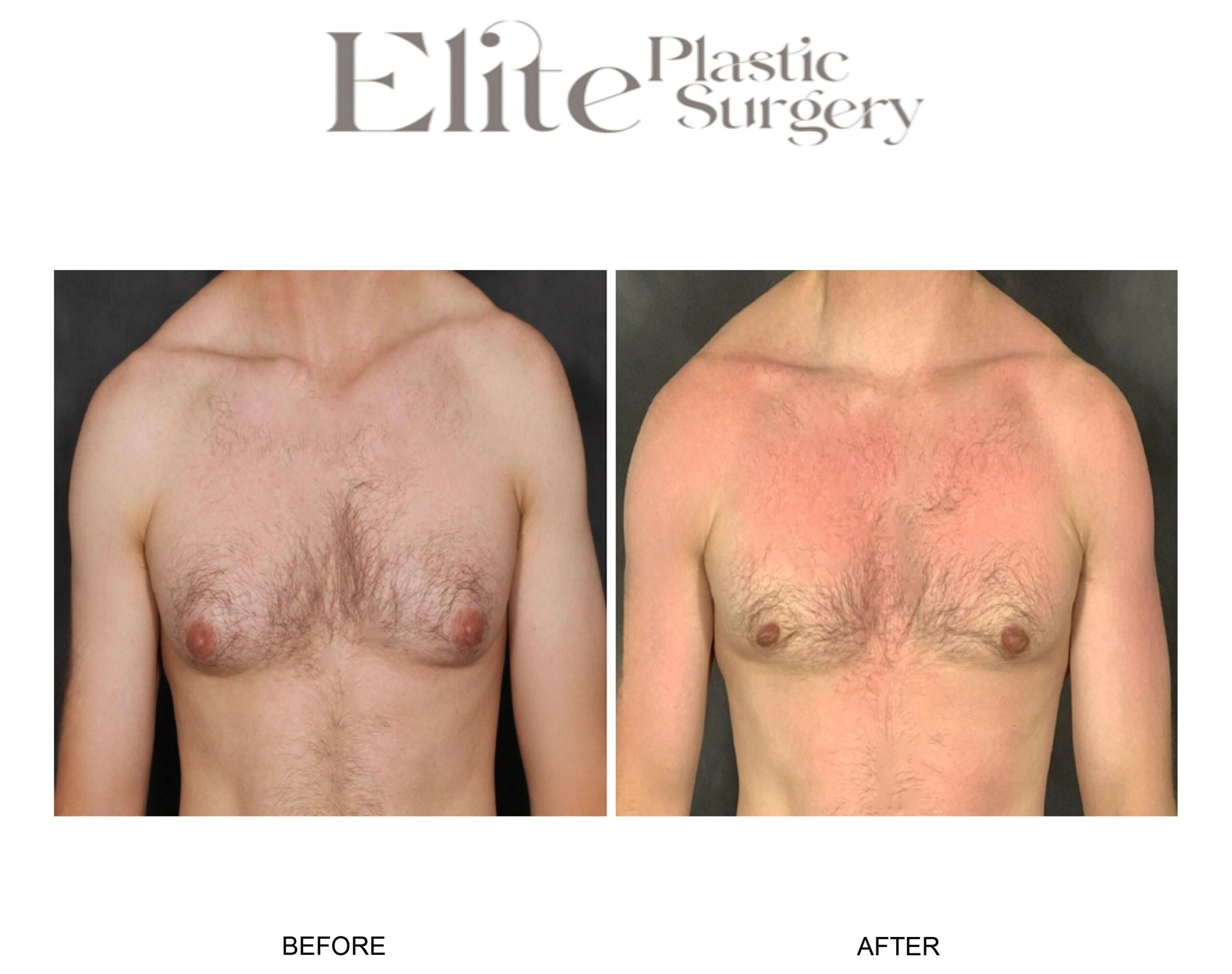 Real patient results before and after plastic surgery results in Arizona, performed by Dr. Torabi