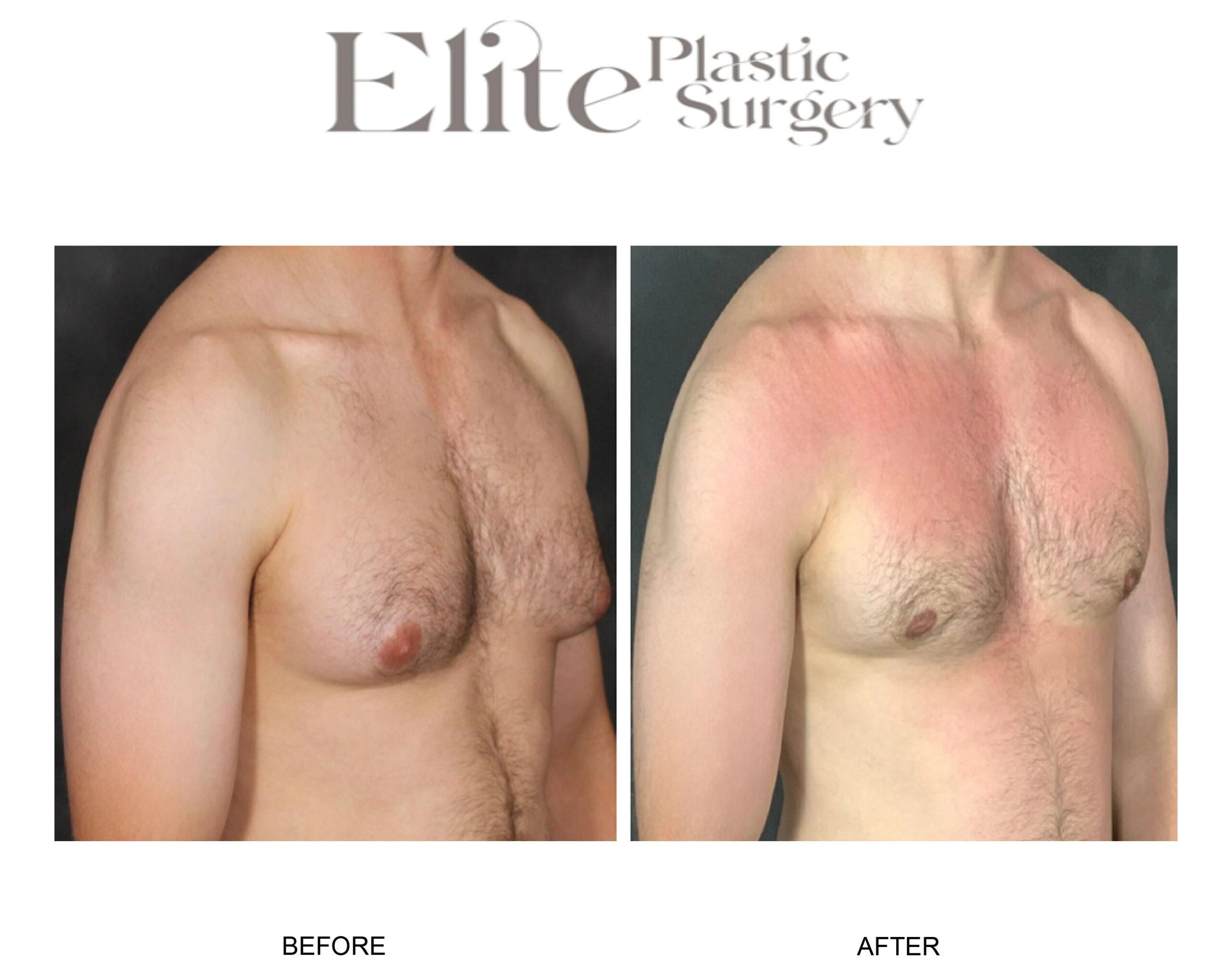 Real patient results before and after plastic surgery results in Arizona, performed by Dr. Torabi