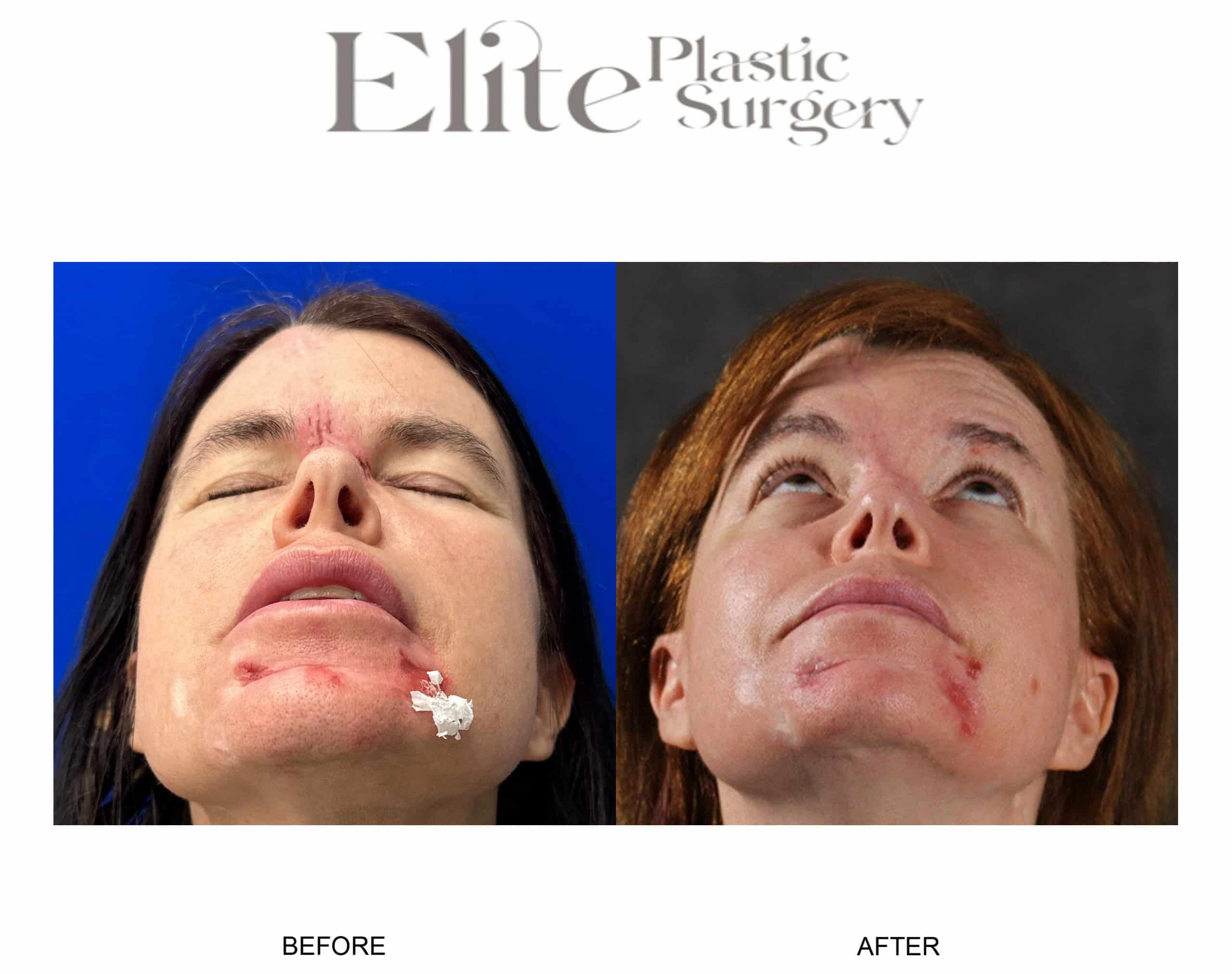 Real patient results before and after plastic surgery results in Arizona, performed by Dr. Torabi