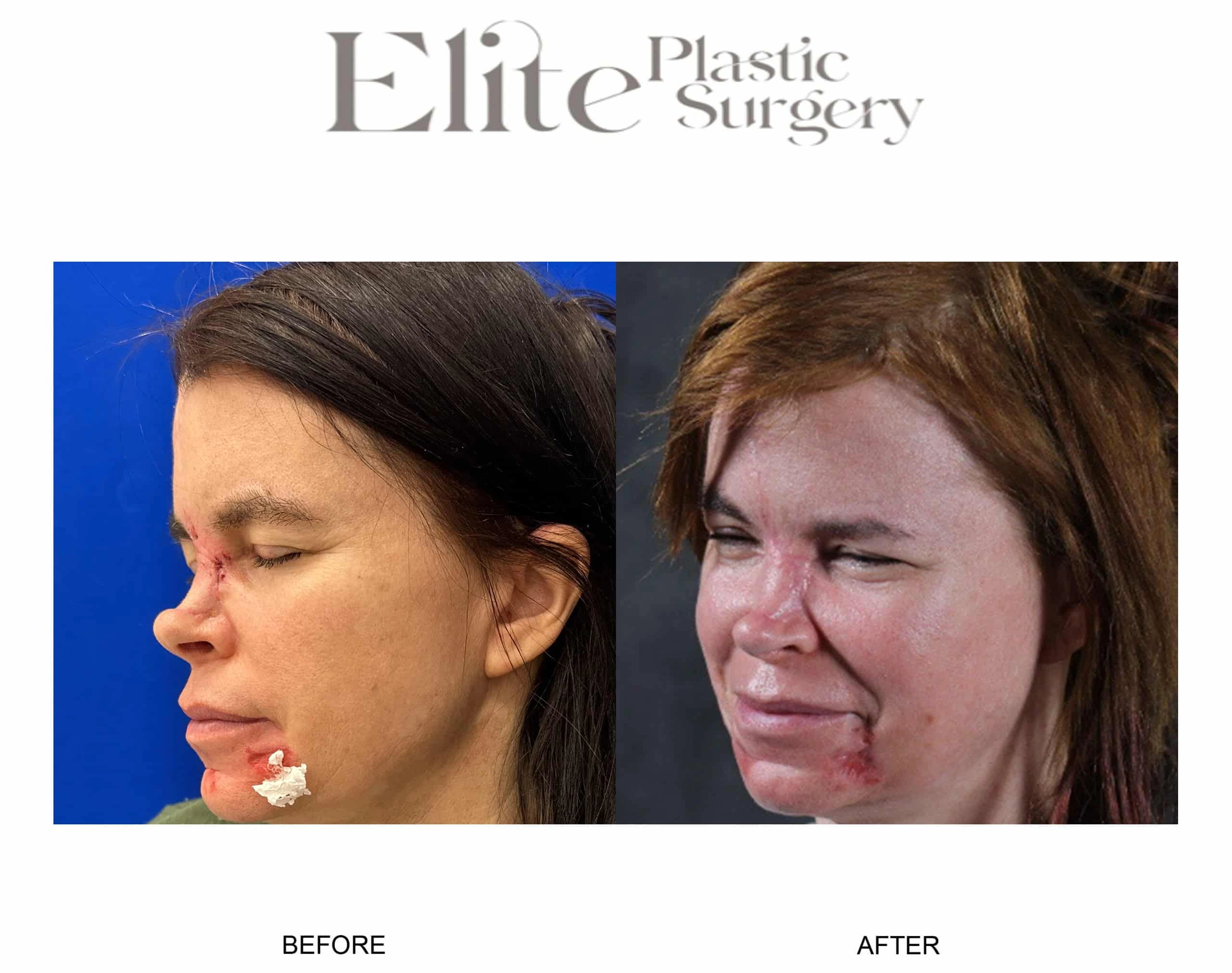 Real patient results before and after plastic surgery results in Arizona, performed by Dr. Torabi
