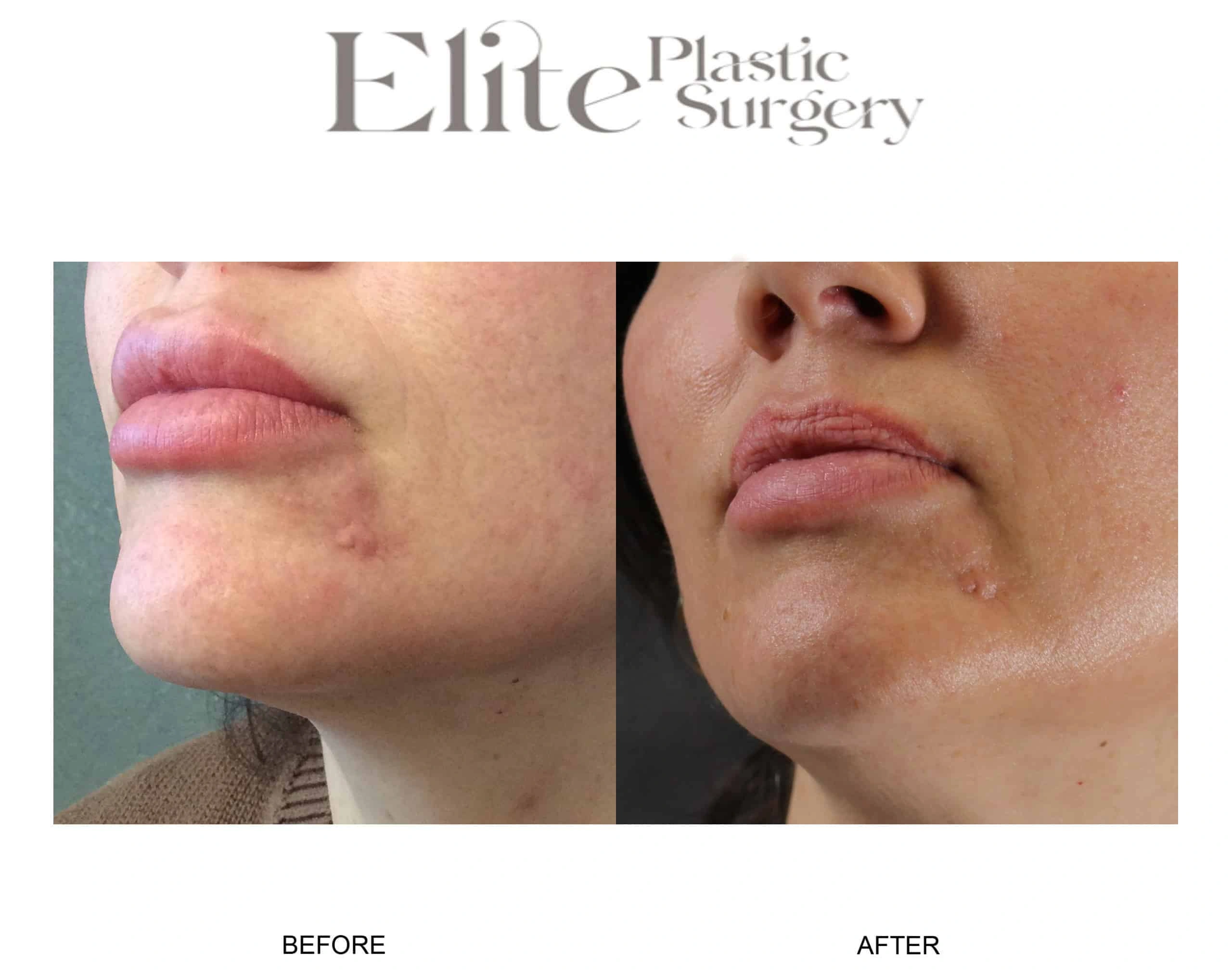 Real patient results before and after plastic surgery results in Arizona, performed by Dr. Torabi
